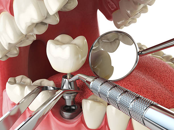 Best Broken or Cracked Tooth Emergency Dentist in Loving, NM